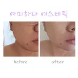 물광 속광 겉광까지 잡아주는 여미하다 에스테틱 후기!